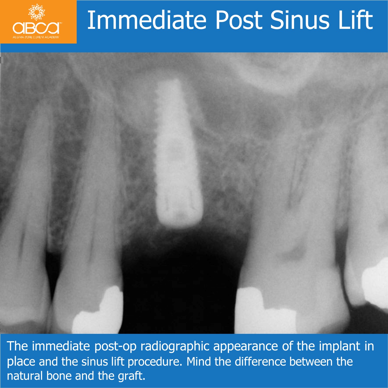 Clinical Case